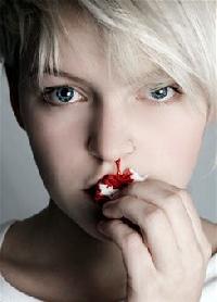 Epistaxis - sau hemoragia nazală