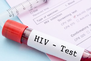 Tratamentul pentru HIV s-ar putea baza pe o singura pilula luata saptamanal