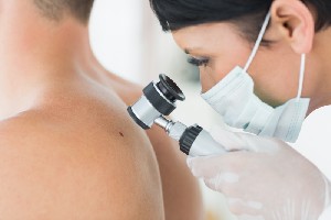 Pierderea în greutate reduce riscul de cancer de piele
