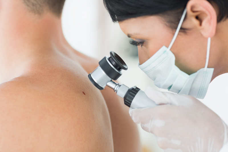 Pierderea în greutate reduce riscul de cancer de piele